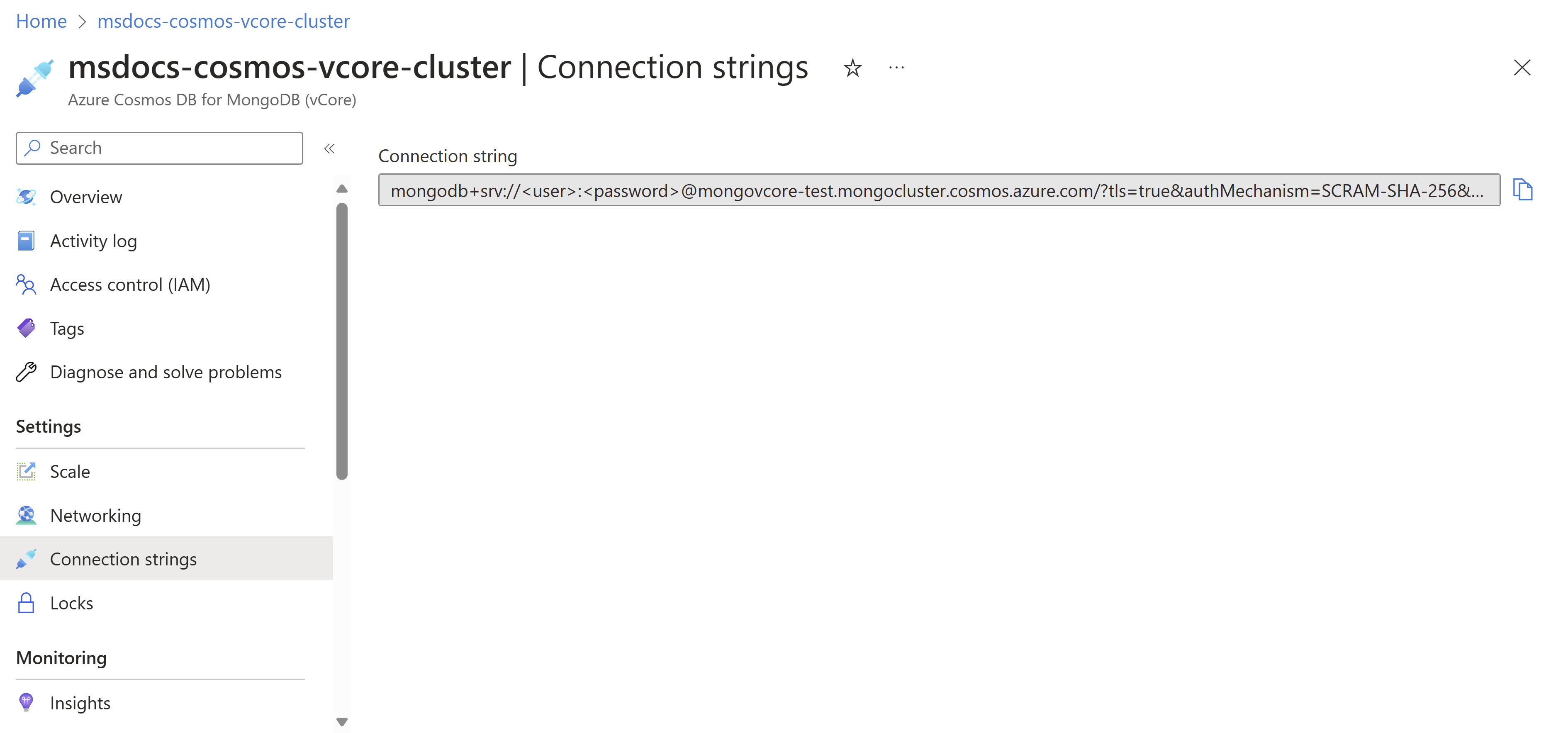 Screenshot of the pane for connection strings.